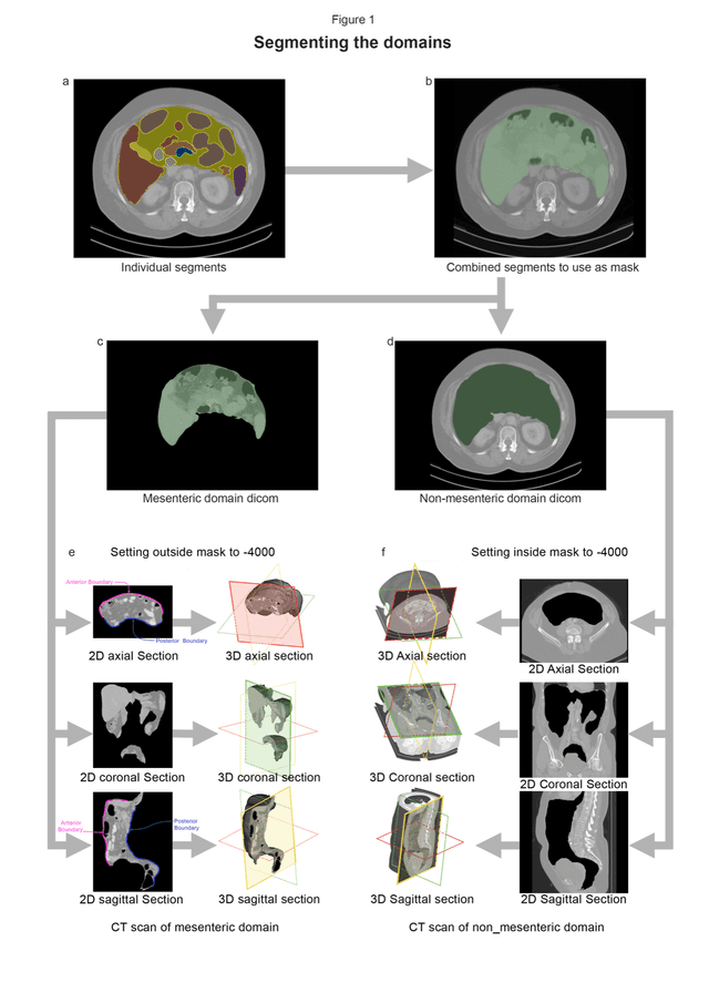 CT Reconstruction Example