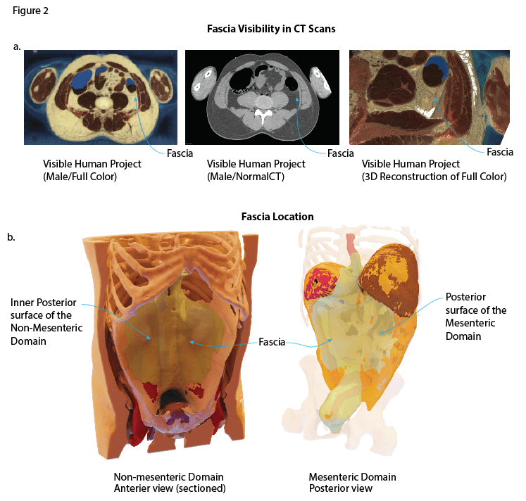 Visible Human Project images, CT and 3D reconstructions showing the fascia and its location between the abdominal domains.