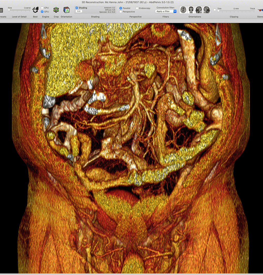 Medical imaging integration CT-based analysis